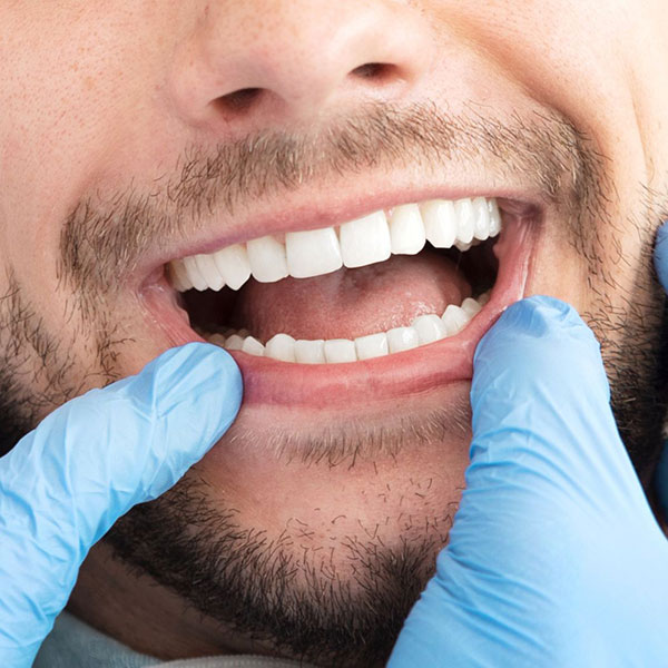 close up of a man's teeth