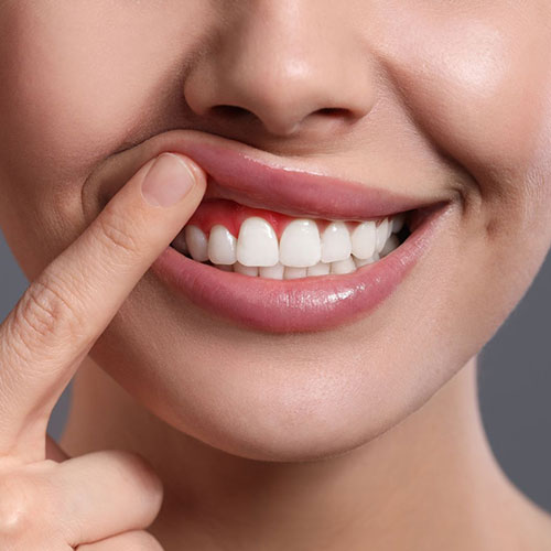 close up of inflamed gums